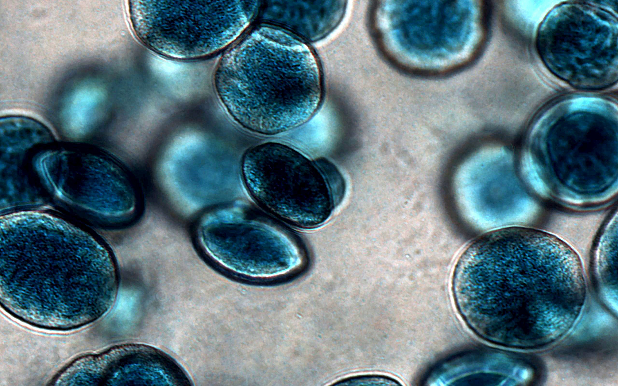 Vespersiii Hlm Blue Pigment Bacteria Response