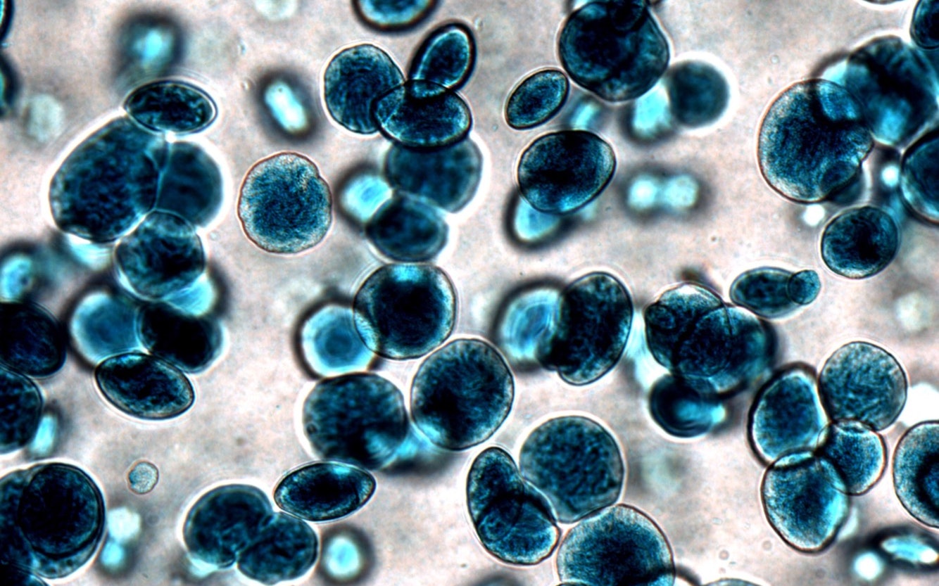 Vespersii Hlm Blue Pigment Bacteria Across Surface